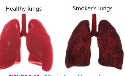 Fig 2.12: Effect of smoking on lungs