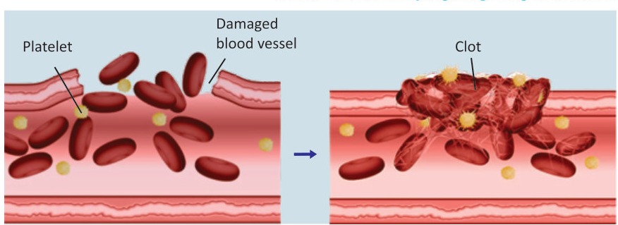 Fig 3.4: Formation of clot by platelets