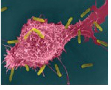 Fig 9.3: A macrophage attacking microbes